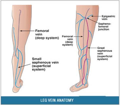 myths about varicose veins