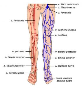 Painful varicose veins