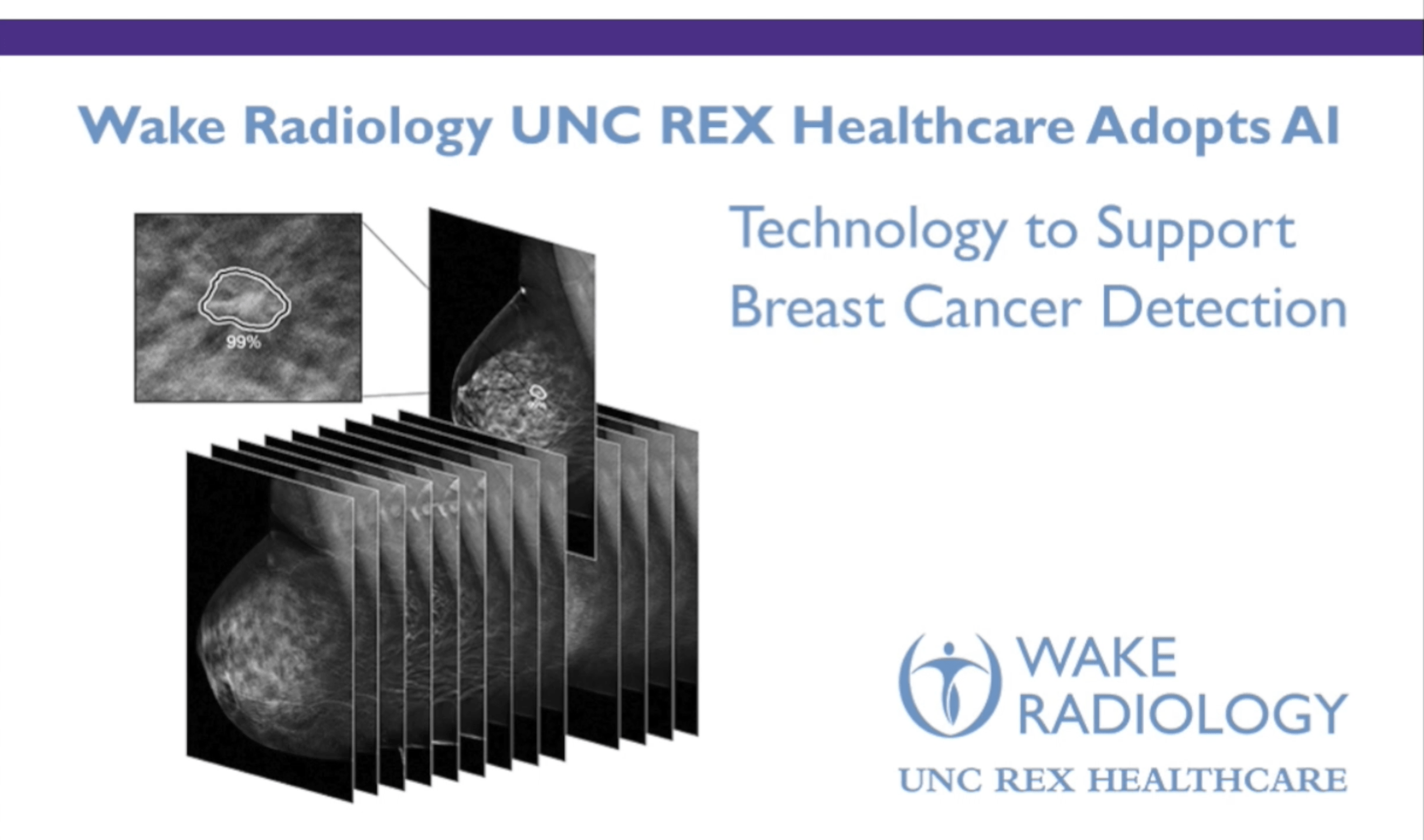 Wake Radiology UNC REX Healthcare Introduces Profound AI