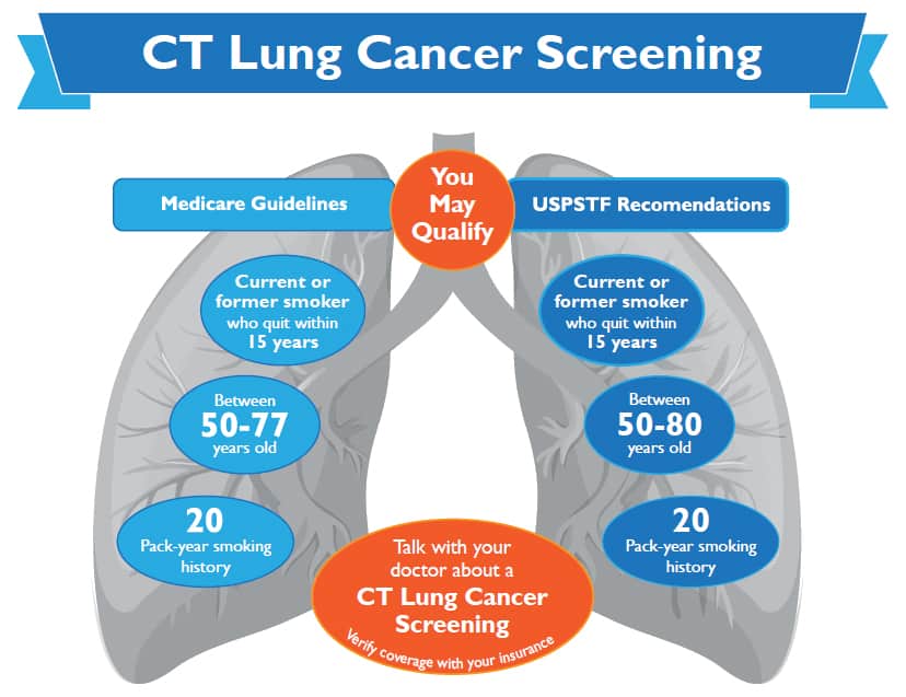 farligt Habubu Anvendt CT Lung Cancer Screenings | WakeRad UNC REX
